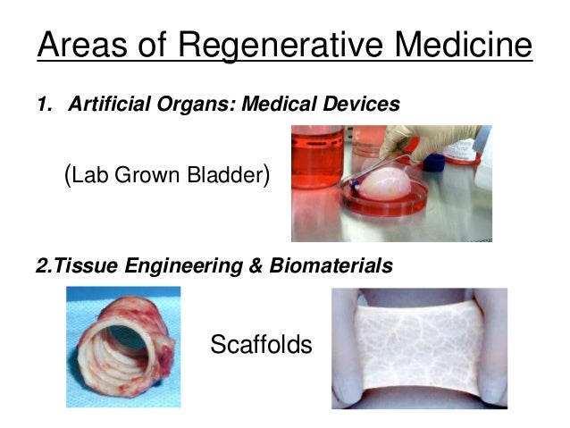 Tissue Engineering in Regenerative Medicine